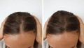AnnurMets-Hair-60-tabletek.jpg